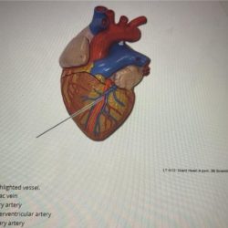 Identify the highlighted vessel heart