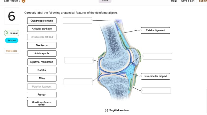 Correctly label the following parts of the femur