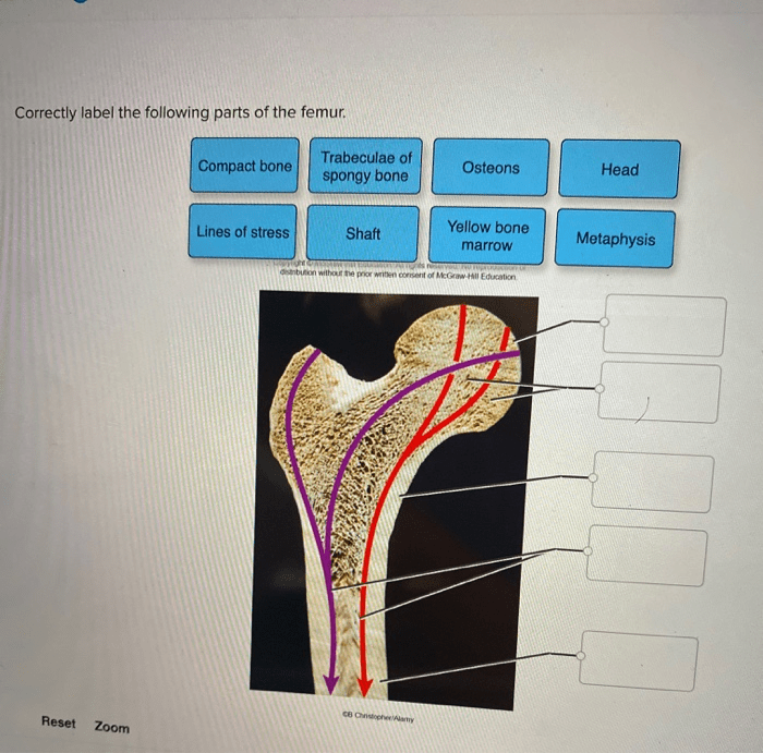 Correctly label the following parts of the femur